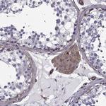 MYH9 Antibody in Immunohistochemistry (Paraffin) (IHC (P))