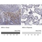 IRF4 Antibody