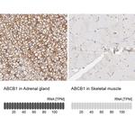 P-Glycoprotein Antibody