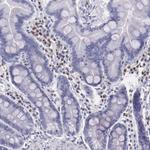 IRF4 Antibody in Immunohistochemistry (Paraffin) (IHC (P))