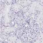 IRF4 Antibody in Immunohistochemistry (Paraffin) (IHC (P))