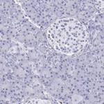 IRF4 Antibody in Immunohistochemistry (Paraffin) (IHC (P))