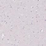 CD206 Antibody in Immunohistochemistry (Paraffin) (IHC (P))