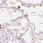 CD206 Antibody in Immunohistochemistry (Paraffin) (IHC (P))