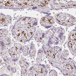 CD206 Antibody in Immunohistochemistry (Paraffin) (IHC (P))