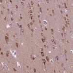 GAS7 Antibody in Immunohistochemistry (Paraffin) (IHC (P))