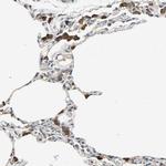 IRF3 Antibody in Immunohistochemistry (Paraffin) (IHC (P))