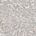 CNOT4 Antibody in Immunohistochemistry (Paraffin) (IHC (P))