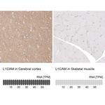 CD171 Antibody