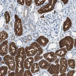 FBP1 Antibody in Immunohistochemistry (Paraffin) (IHC (P))