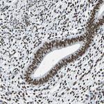 FUBP1 Antibody in Immunohistochemistry (Paraffin) (IHC (P))