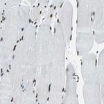 FUBP1 Antibody in Immunohistochemistry (Paraffin) (IHC (P))