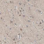 MPI Antibody in Immunohistochemistry (Paraffin) (IHC (P))