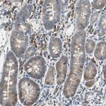 MPI Antibody in Immunohistochemistry (Paraffin) (IHC (P))