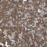 MPI Antibody in Immunohistochemistry (Paraffin) (IHC (P))