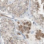 MPI Antibody in Immunohistochemistry (Paraffin) (IHC (P))