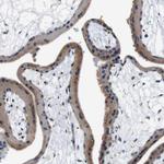 LRP4 Antibody in Immunohistochemistry (Paraffin) (IHC (P))