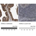 SGMS2 Antibody