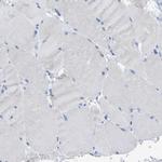 CD98 Antibody in Immunohistochemistry (Paraffin) (IHC (P))