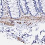 Amphiphysin Antibody in Immunohistochemistry (Paraffin) (IHC (P))