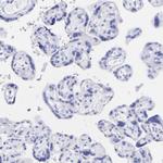 Amphiphysin Antibody in Immunohistochemistry (Paraffin) (IHC (P))