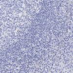 Amphiphysin Antibody in Immunohistochemistry (Paraffin) (IHC (P))