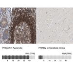 PRKD2 Antibody