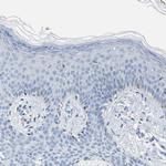 Carbonic Anhydrase III Antibody in Immunohistochemistry (Paraffin) (IHC (P))