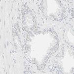 Cytokeratin 20 Antibody in Immunohistochemistry (Paraffin) (IHC (P))