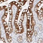 Cytokeratin 20 Antibody in Immunohistochemistry (Paraffin) (IHC (P))