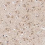 MPP2 Antibody in Immunohistochemistry (Paraffin) (IHC (P))