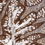 DAAM1 Antibody in Immunohistochemistry (Paraffin) (IHC (P))