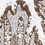 ETHE1 Antibody in Immunohistochemistry (Paraffin) (IHC (P))