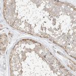 ETHE1 Antibody in Immunohistochemistry (Paraffin) (IHC (P))