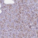 LYAG Antibody in Immunohistochemistry (Paraffin) (IHC (P))