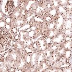 HOXA5 Antibody in Immunohistochemistry (Paraffin) (IHC (P))