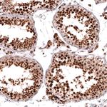 HOXA5 Antibody in Immunohistochemistry (Paraffin) (IHC (P))