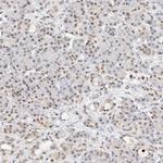 NRF1 Antibody in Immunohistochemistry (Paraffin) (IHC (P))