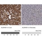 ALDH5A1 Antibody