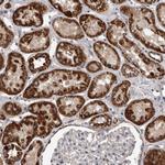 ALDH5A1 Antibody in Immunohistochemistry (Paraffin) (IHC (P))