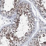 Menin Antibody in Immunohistochemistry (Paraffin) (IHC (P))