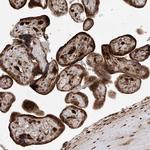 LATS1 Antibody in Immunohistochemistry (Paraffin) (IHC (P))