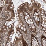 LATS1 Antibody in Immunohistochemistry (Paraffin) (IHC (P))