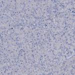 LPIN1 Antibody in Immunohistochemistry (Paraffin) (IHC (P))