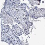 LPIN1 Antibody in Immunohistochemistry (Paraffin) (IHC (P))