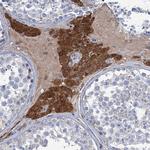 LPIN1 Antibody in Immunohistochemistry (Paraffin) (IHC (P))