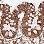 ATP5A1 Antibody in Immunohistochemistry (Paraffin) (IHC (P))