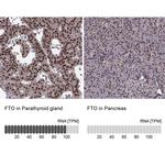 FTO Antibody