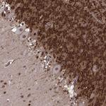 FTO Antibody in Immunohistochemistry (Paraffin) (IHC (P))