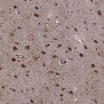 FTO Antibody in Immunohistochemistry (Paraffin) (IHC (P))